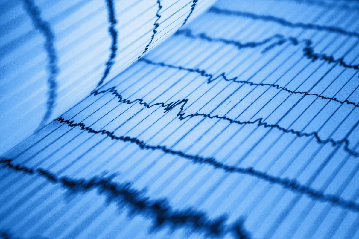 A recorded measurement trace printed on graph paper.